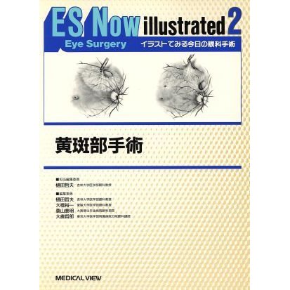 黄斑部手術 イラストでみる今日の眼科手術２／樋田哲夫(編者),大橋裕一(編者),桑山泰明(編者),大鹿哲郎(編者)