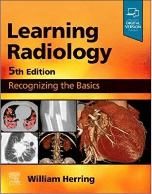Learning Radiology: Recognizing the Basics 5/e Herring 2023 Elsevier