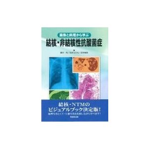 画像と病理から学ぶ 結核・非結核性抗酸菌症   徳田均  〔本〕