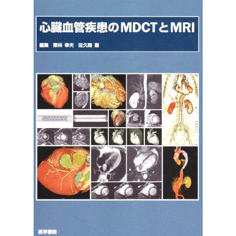 心臓血管疾患のMDCTとMRI