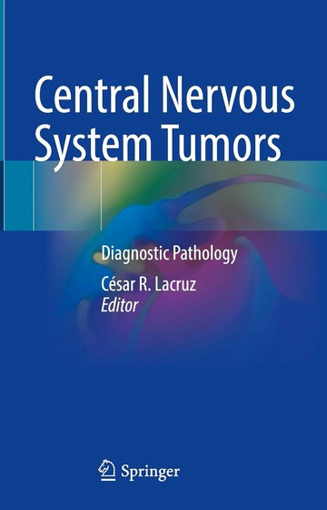 Central Nervous System Tumors 1/e César R. Lacruz 2024 Springer