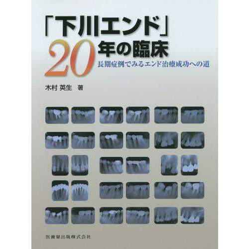 下川エンド 20年の臨床長期症例でみるエンド治療成功への道