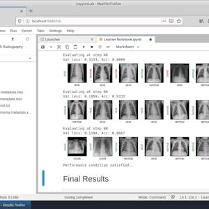 Detecting COVID-19 with Chest X-Ray using PyTorch