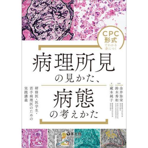 CPC形式でわかる身につく病理所見の見かた,病態の考えかた 研修医・医学生・若手病理医のための実践講義