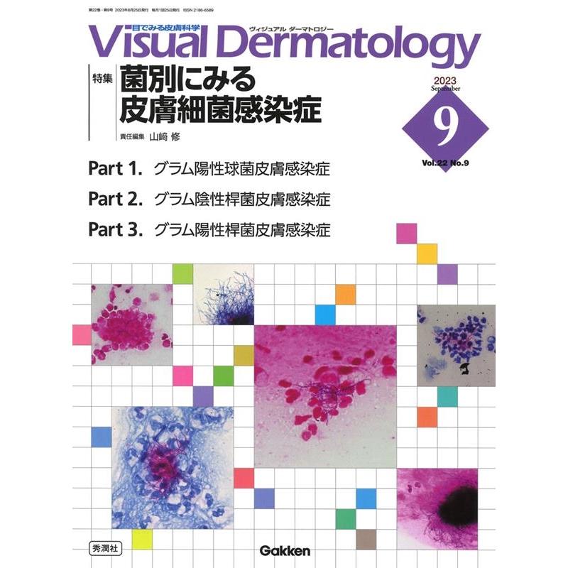 Visual Dermatology 目でみる皮膚科学 Vol.22No.9