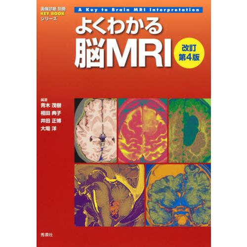 よくわかる脳MRI 改訂第4版