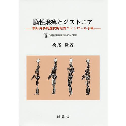 脳性麻痺とジストニア 整形外科的選択的痙性コントロール手術