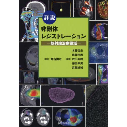 詳説非剛体レジストレーション 放射線治療領域