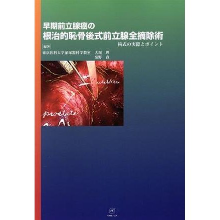 早期前立腺癌の根治的恥骨後式前立腺全摘除術　術式の実際とポイ／大堀理(著者),秦野直(著者)