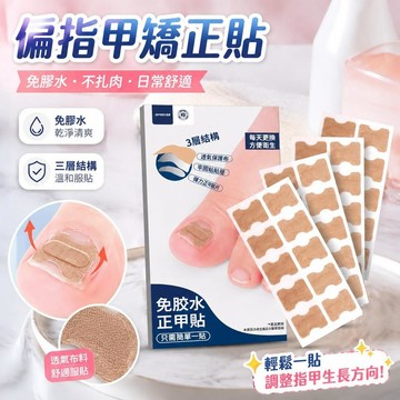 ⚡台灣出貨⚡新款正甲貼甲溝炎矯正器嵌甲專用腳指甲扎肉趾甲往肉里長糾正卷甲神器