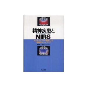 精神疾患とNIRS 光トポグラフィー検査による脳機能イメージング