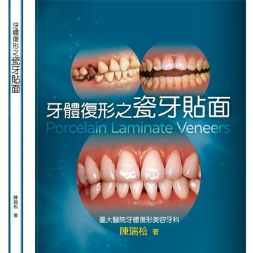 金名-建宏 牙體復形之瓷牙貼面 2022/01 9789579519892 <建宏書局>