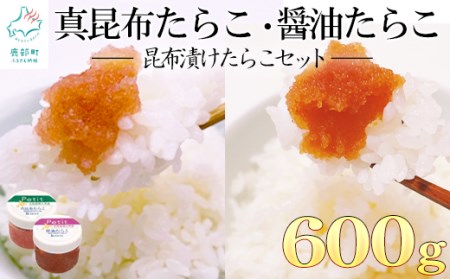 小分けで便利！昆布漬けたらこセット600g