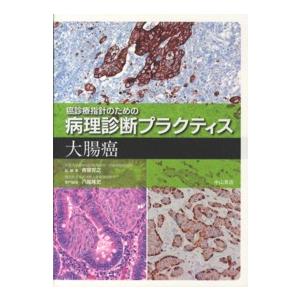 癌診療指針のための病理診断プラクティス　大腸癌