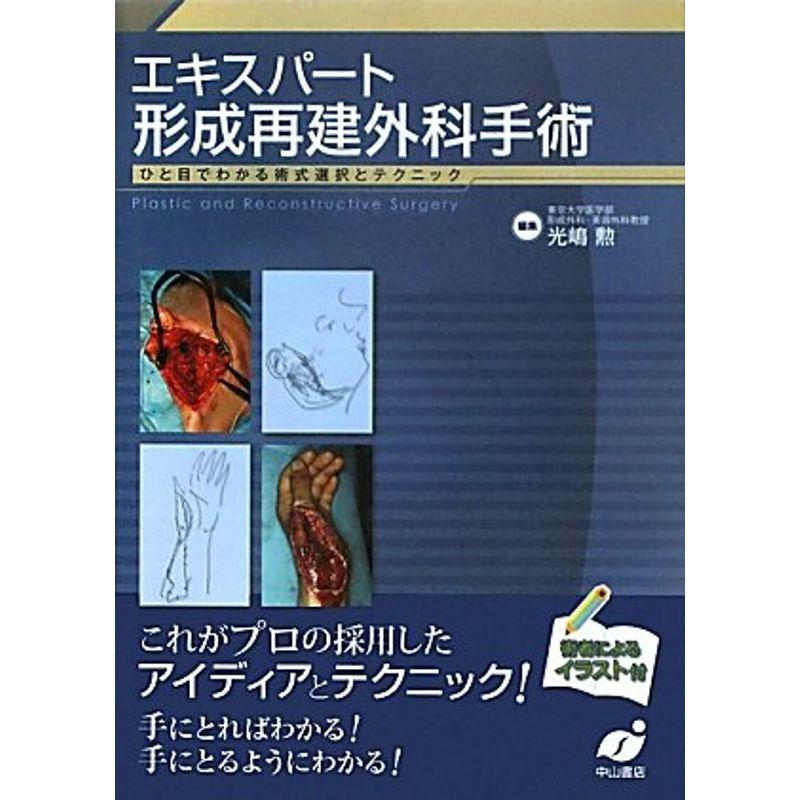 エキスパート形成再建外科手術?ひと目でわかる術式選択とテクニック