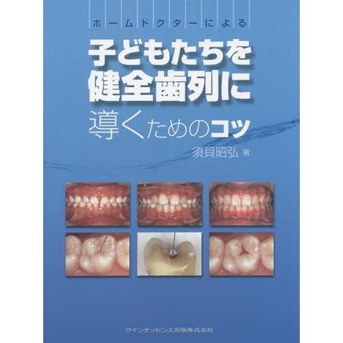 ホームドクターによる子どもたちを健全歯列に導くためのコツ