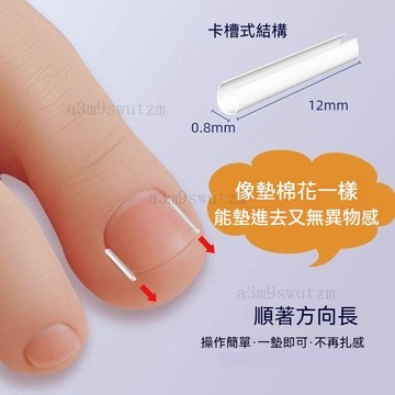 臺灣出貨👍卷甲正器 甲溝神器 指甲分離器 嵌甲 甲溝墊 嵌甲 指甲正器 凍甲 甲溝分離andoi