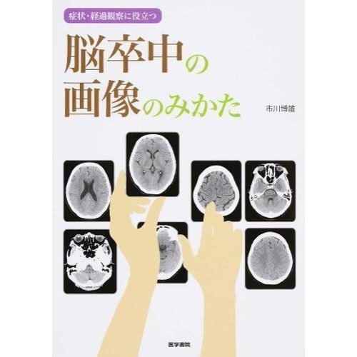 脳卒中の画像のみかた 症状・経過観察に役立つ