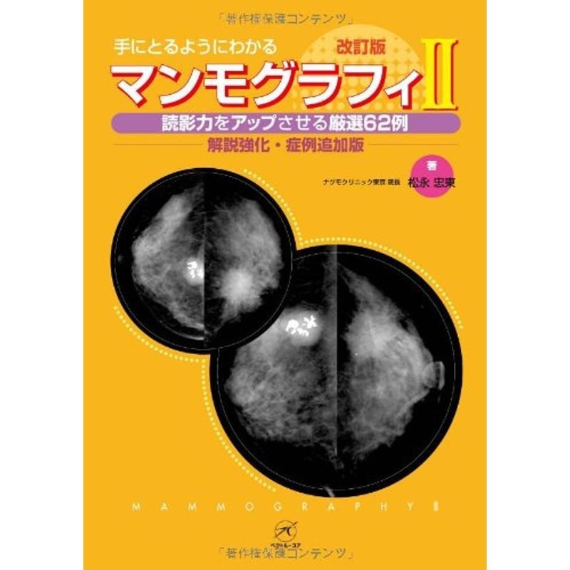 マンモグラフィII 改訂版〜読影力をアップさせる厳選62例〜解説強化・症例追加版 (手にとるようにわかる)