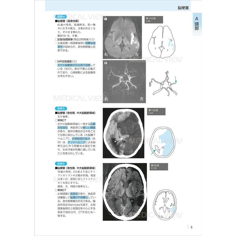 医学生のための画像診断マニュアル 国試問題攻略ガイド