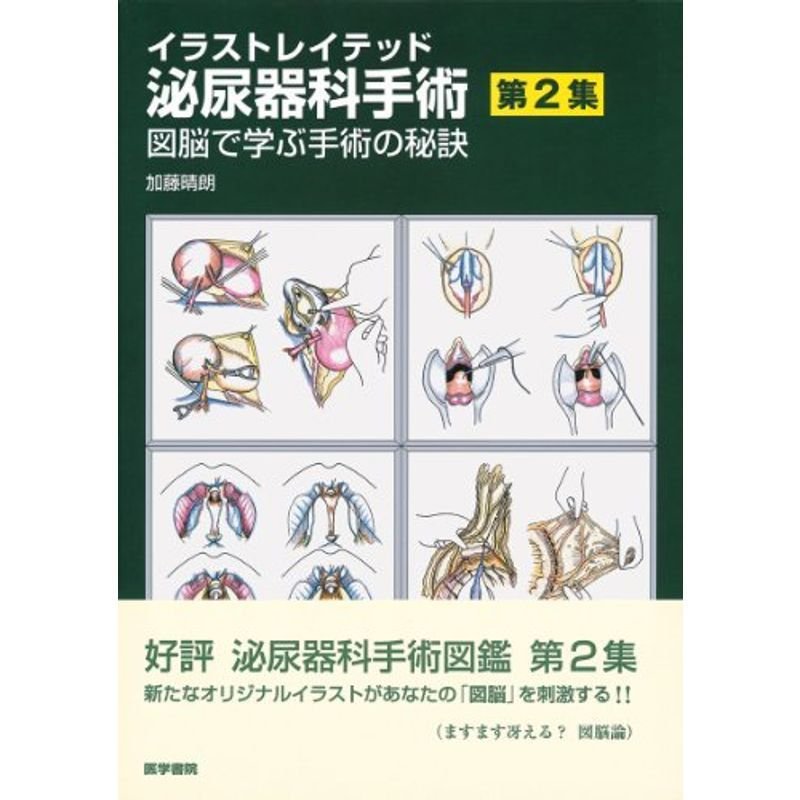 イラストレイテッド泌尿器科手術 第2集 図脳で学ぶ手術の秘訣