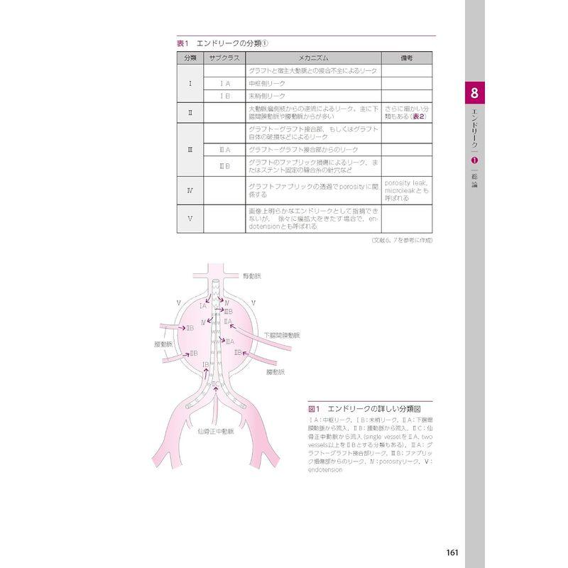 ステントグラフト内挿術マニュアル 腹部編動画を含む電子版付