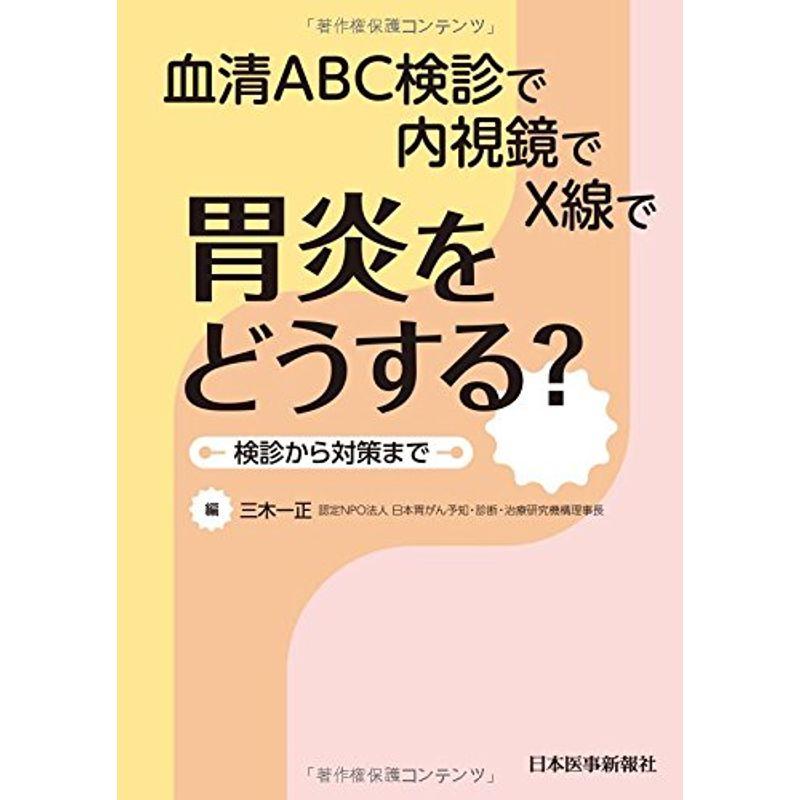 胃炎をどうする? 血清ABC検診で 内視鏡で X線で