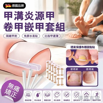 🚀隔日現發🚀修腳趾甲捲甲三件套 甲溝炎矯正貼 修凍甲矯正貼片 腳趾甲紮肉貼 正甲器 指甲甲溝嵌甲分離墊 正