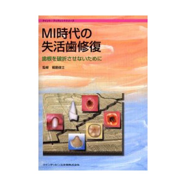 MI時代の失活歯修復 歯根を破折させないために