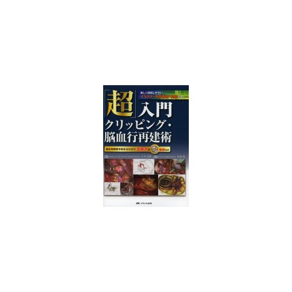 超 入門 クリッピング・脳血行再建術 脳血管障害手術まるわかり 全術式 