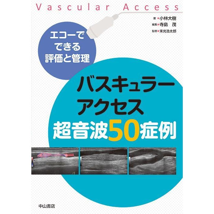 バスキュラーアクセス超音波５０症例-エコーでできる評価と管理