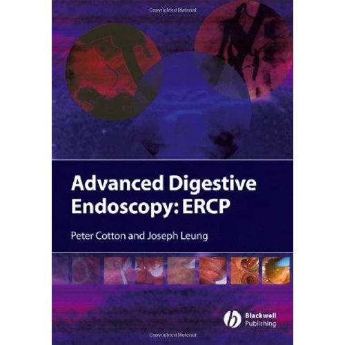 Advanced Digestive Endoscopy: ERCP