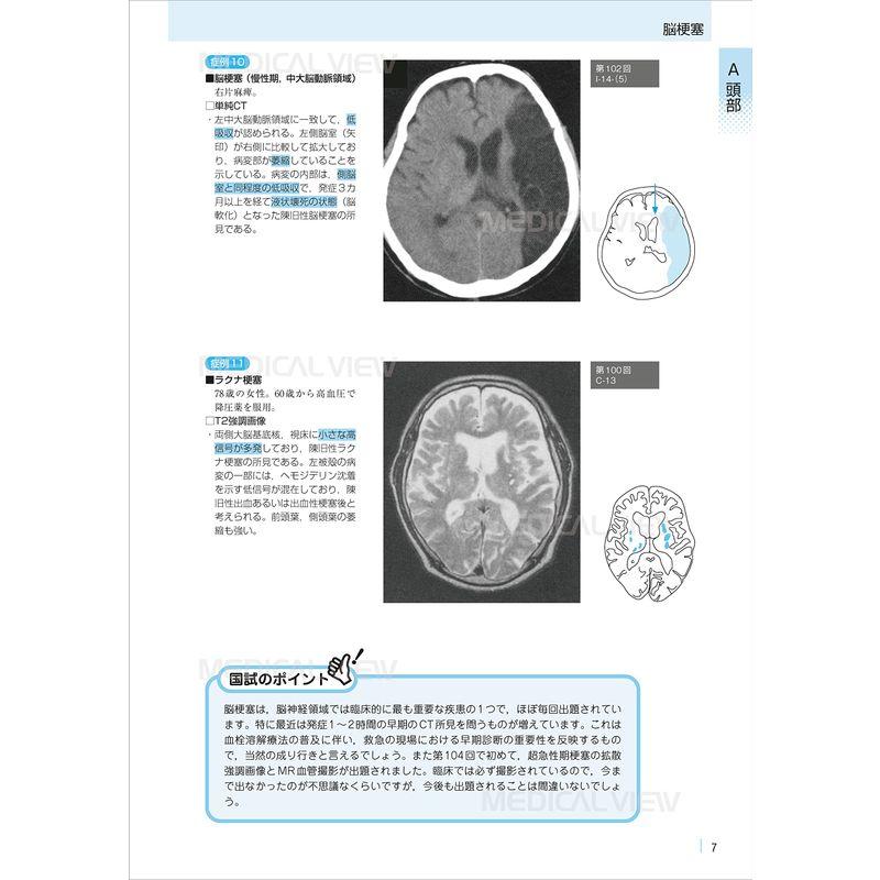 医学生のための画像診断マニュアル 国試問題攻略ガイド