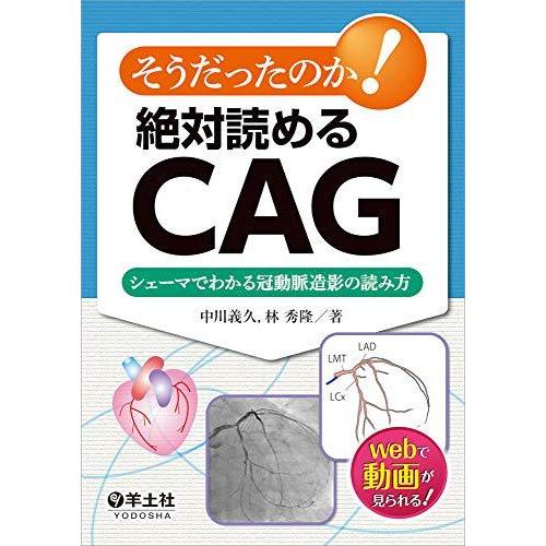 そうだったのか!  絶対読めるCAG?シェーマでわかる冠動脈造影の読み方