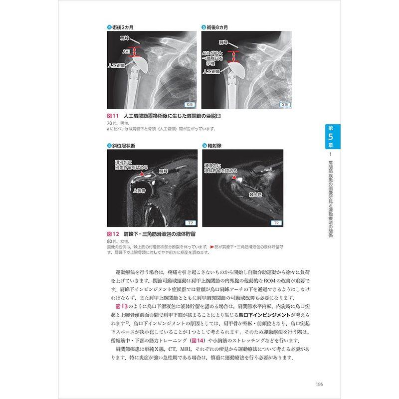 リハビリに直結する 運動器画像の見かた