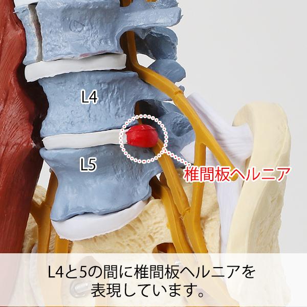 7ウェルネ 脊椎模型 人体模型 主要筋 靭帯 神経 血管 付 実物大 骨格模型 骨格標本 骨模型 骸骨模型 人骨模型 骨格モデル 人体モデル