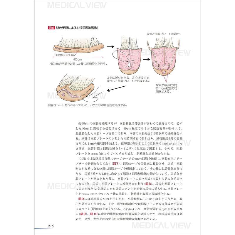 膀胱癌診療最前線