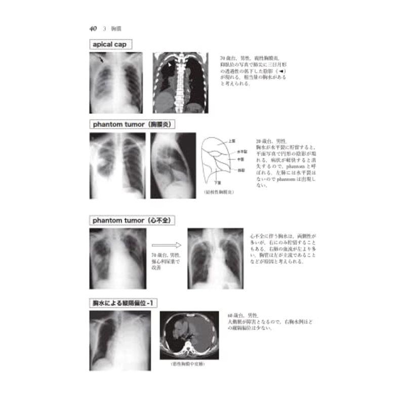 胸部X線・CT画像420症例