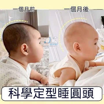 臺灣出貨🔥 嬰兒定型枕 寶寶防偏枕頭糾正頭型正躺睡神器 定型枕 兒童枕 寶寶枕 安撫枕 寶寶頭型枕 新生兒枕 凹洞枕