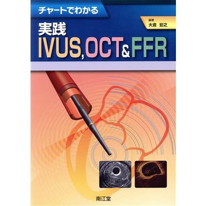 実践ＩＶＵＳ，ＯＣＴ＆ＦＦＲ／大倉宏之(著者)