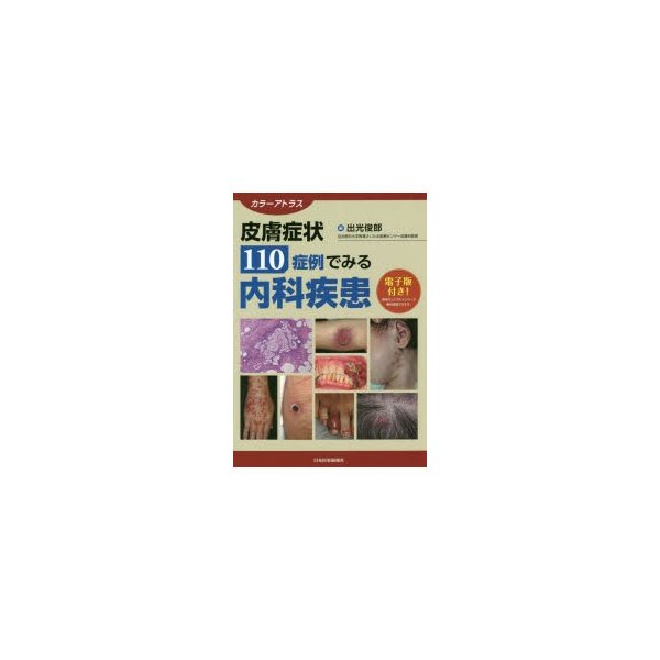 皮膚症状110症例でみる内科疾患 カラーアトラス