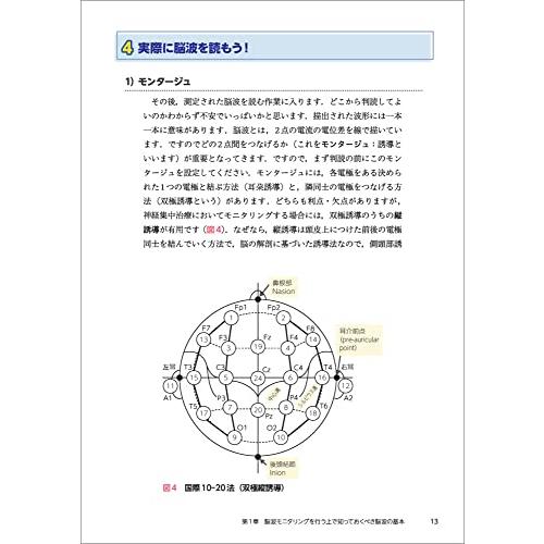 見えない発作を見逃さない ICUでの脳波モニタリング 神経集中治療に強くなる