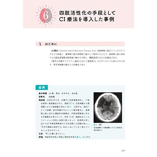 臨床で使える 半側空間無視への実践的アプローチ