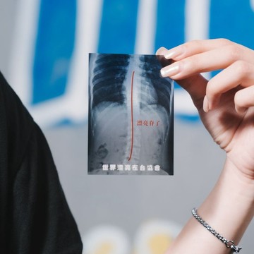 【世界漂亮在台協會】漂亮脊了脊歪人X光片小卡