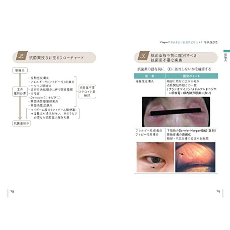 眼科抗菌薬 適正使用マニュアル