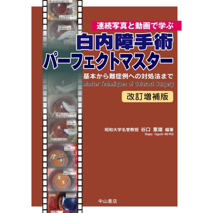 白内障手術パーフェクトマスター 連続写真と動画で学ぶ 基本から難症例