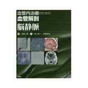 血管内治療のための血管解剖　脳静脈   清末　一路　編著