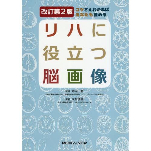 コツさえわかればあなたも読める リハに役立つ脳画像 改訂第2版