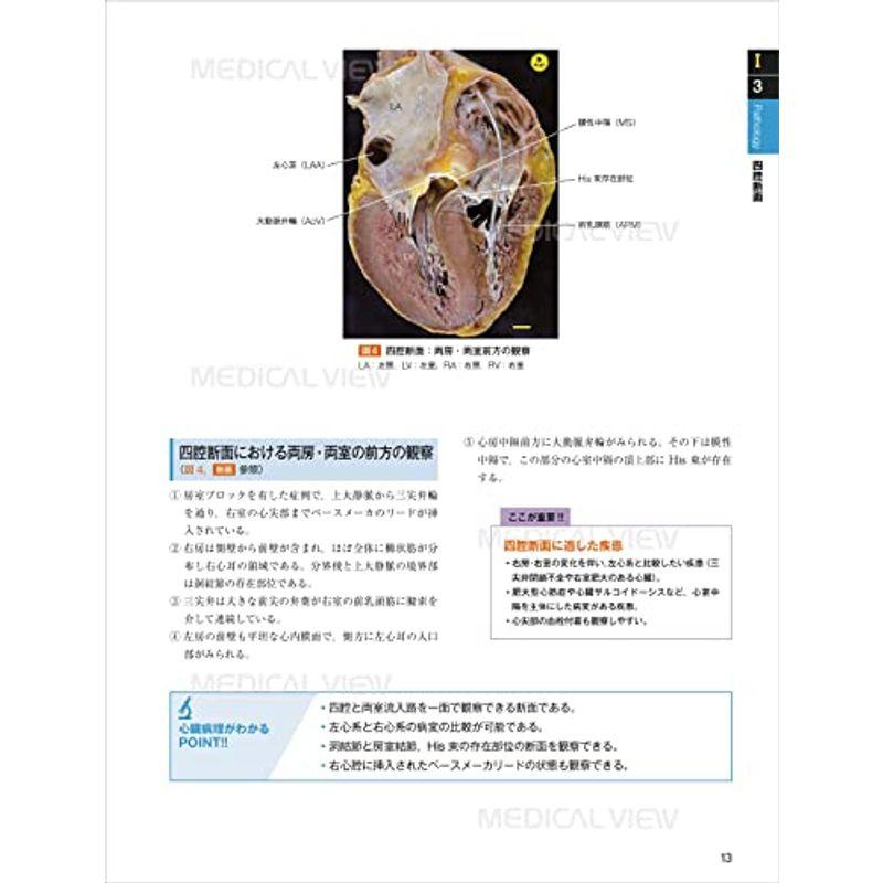 心エコー図検査に役立つ ヒト心臓形態のすべて