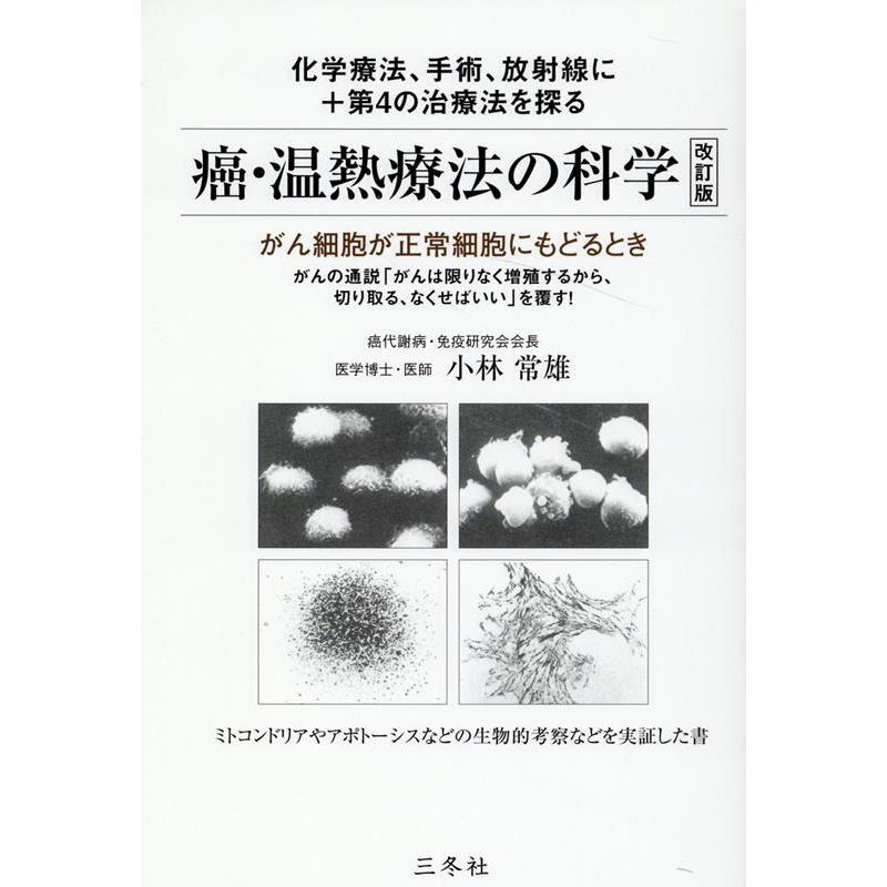 癌・温熱療法の科学 がん細胞が正常細胞にもどるとき